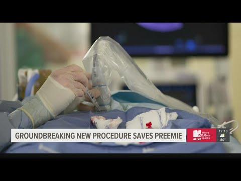 1 pound, 1 ounce baby girl undergoes new heart surgery at  Children's Healthcare of Atlanta