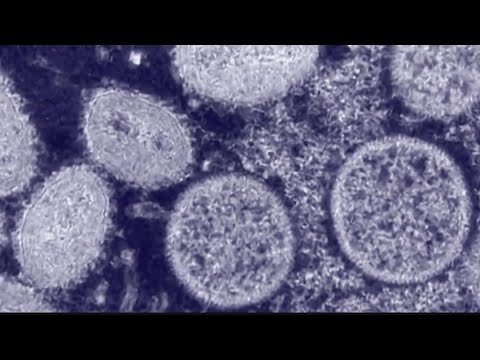 Monkeypox cases rise in Georgia again