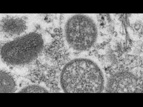CDC announces monkeypox vaccination program