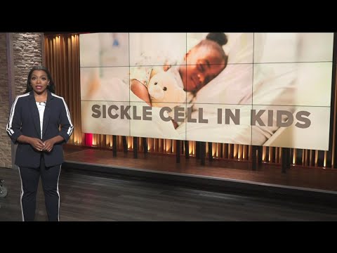 CDC issues warning about sickle cell disease in kids