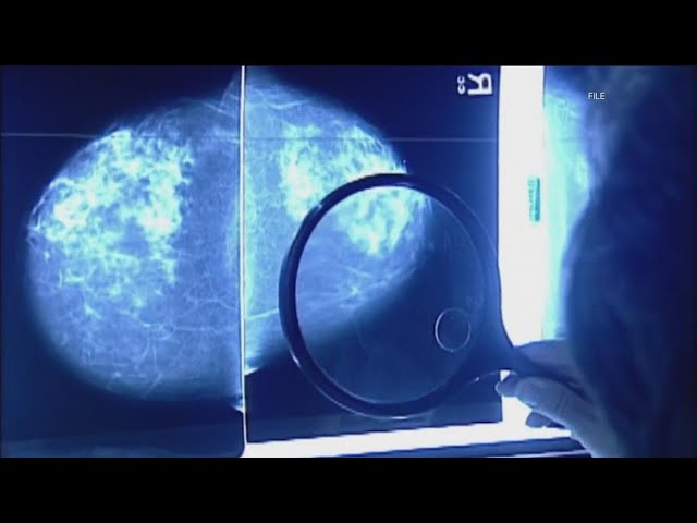 Doctors see growth in young women's breast cancer diagnoses