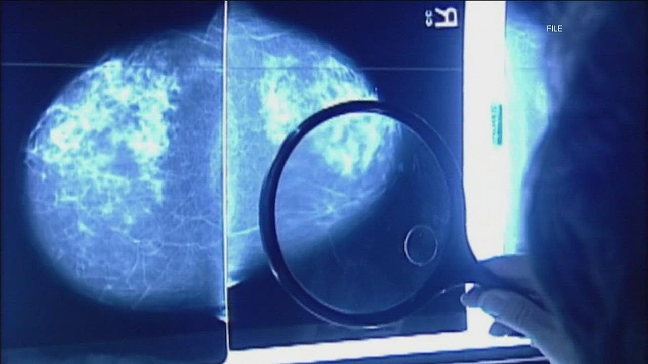 Doctors see increase in early breast cancer diagnoses