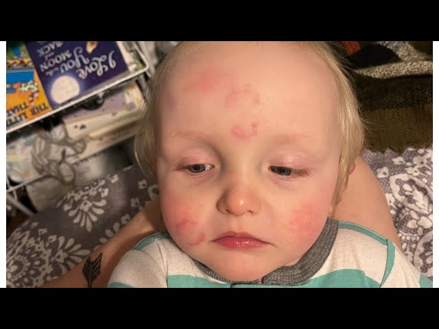 'He had bite marks all over' | Clayton Co. daycare now under investigation